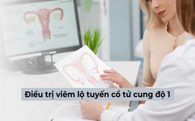 [Tổng hợp] Các cách điều trị viêm lộ tuyến cổ tử cung độ 1 hiện nay