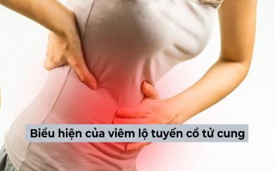 Mách bạn cách nhận biết biểu hiện của viêm lộ tuyến cổ tử cung