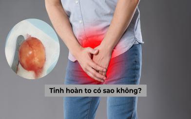 Tinh hoàn to có sao không? Nguyên nhân và cách khắc phục