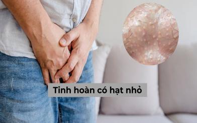 Tinh hoàn có hạt nhỏ là bệnh gì? [7 bệnh lý thường gặp]