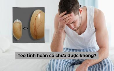 Teo tinh hoàn có chữa được không? Lắng nghe chuyên gia giải đáp