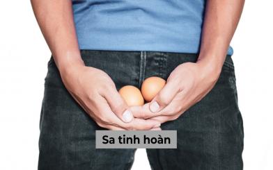 Bạn biết gì về bệnh sa tinh hoàn, làm sao để điều trị hiệu quả?