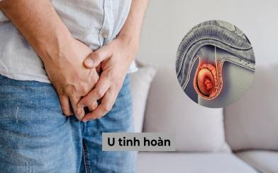 U tinh hoàn: Dấu hiệu nhận biết và cách điều trị hiện nay