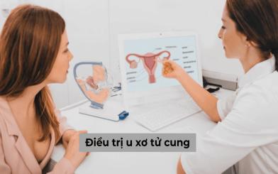 Điều trị u xơ tử cung bằng phương pháp nào hiệu quả?