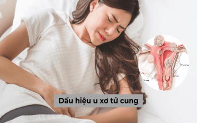 Dấu hiệu u xơ tử cung và những thông tin bạn không nên bỏ qua