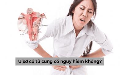 Giải đáp cho người bệnh: U xơ cổ tử cung có nguy hiểm không?