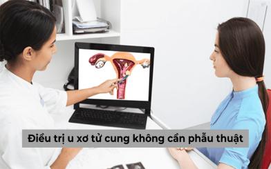 Điều trị u xơ tử cung không cần phẫu thuật liệu có được hay không?