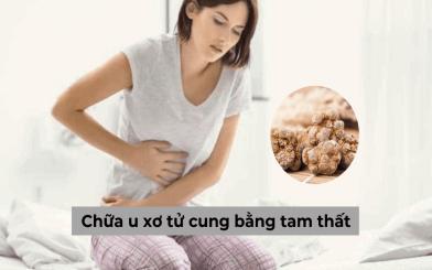 Cách chữa u xơ tử cung bằng tam thất - Những điều cần lưu ý