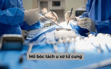 Tổng hợp về một số vấn đề liên quan tới mổ bóc tách u xơ tử cung