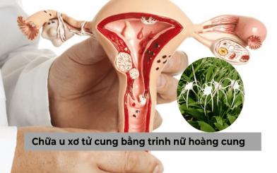 Chữa u xơ tử cung bằng trinh nữ hoàng cung có tốt không? [Giải đáp]