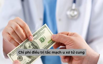 Tìm hiểu chi phí điều trị tắc mạch u xơ tử cung hết bao nhiêu tiền?