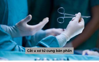 Thế nào là cắt u xơ tử cung bán phần, có nguy hiểm không?