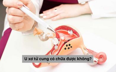 Tìm hiểu: U xơ tử cung có chữa được không?