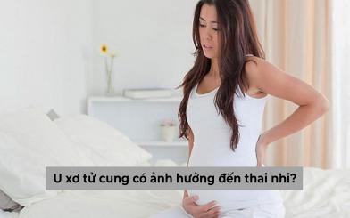 U xơ tử cung có ảnh hưởng đến thai nhi không? [Chuyên gia giải đáp]