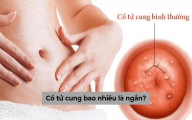 Cổ tử cung bao nhiêu là ngắn? Ảnh hưởng tới khả năng sinh sản không?