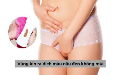 Vùng kín ra dịch màu nâu đen không mùi chị em chớ có chủ quan