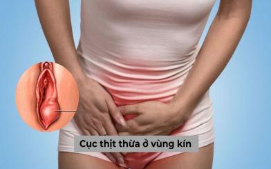 [Giải đáp] Nổi cục thịt thừa ở vùng kín nguy hiểm thế nào?