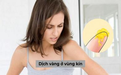 Ra dịch vàng ở vùng kín cảnh báo nhiều bệnh phụ khoa nguy hiểm