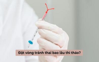 Đặt vòng tránh thai bao lâu thì tháo? Khi nào nên tháo vòng? 