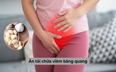 [Thực hư] Ăn tỏi chữa viêm bàng quang có hiệu quả như lời đồn? 