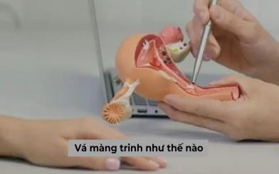 Quy trình vá màng trinh như thế nào, thực hiện ở địa chỉ nào ở Hà Nội thì an toàn?