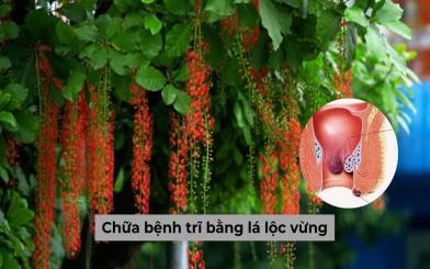 Chữa bệnh trĩ bằng lá lộc vừng liệu có hiệu quả? Nên hay không áp dùng cách chữa này?
