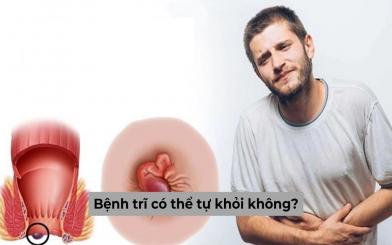 Bệnh trĩ có thể tự khỏi không? Khi nào cần đi khám? 
