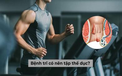 Giải đáp: Người mắc bệnh trĩ có nên tập thể dục hay không?