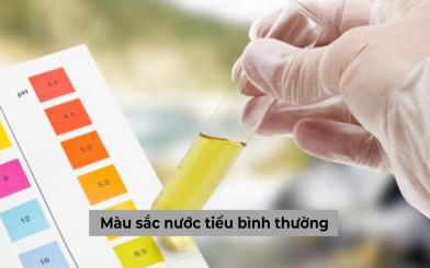 [Góc giải đáp] Thế nào là màu sắc nước tiểu bình thường?
