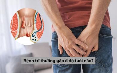 Bệnh trĩ thường gặp ở độ tuổi nào? Làm sao để phòng ngừa?