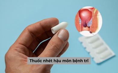 Thuốc nhét hậu môn bệnh trĩ liệu có hiệu quả như bạn vẫn nghĩ?