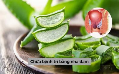 Chữa bệnh trĩ bằng nha đam liệu có phải phương pháp an toàn?
