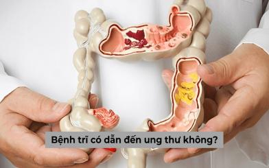 Giải đáp: Mắc bệnh trĩ có dẫn đến ung thư không?