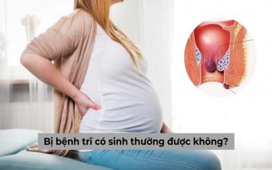 Giải đáp cho mẹ bầu: Đang mang thai mà bị bệnh trĩ có sinh thường được không?