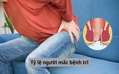 Tỷ lệ người mắc bệnh trĩ đang ngày càng gia tăng - cách giải quyết hiện nay