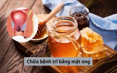 [Chia sẻ] Mẹo chữa bệnh trĩ bằng mật ong đơn giản, hiệu quả