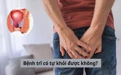 Bệnh trĩ có tự khỏi được không? Giải đáp từ chuyên gia