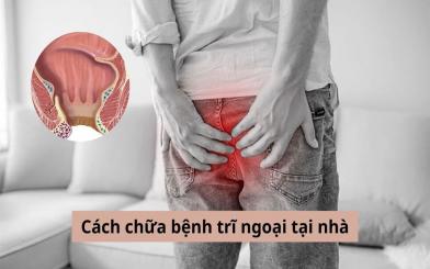 Cách chữa bệnh trĩ ngoại tại nhà được nhiều người bệnh tin dùng