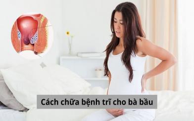 Khám phá những cách chữa bệnh trĩ cho bà bầu được chuyên gia tin tưởng