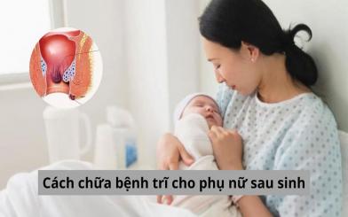 Tham khảo một số cách chữa bệnh trĩ cho phụ nữ sau sinh