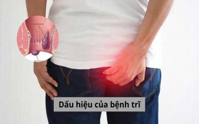 7 Dấu hiệu của bệnh trĩ thường gặp và cách điều trị dứt điểm 