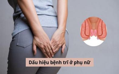 Dấu hiệu bệnh trĩ ở phụ nữ: Nhận biết và cách điều trị hiệu quả