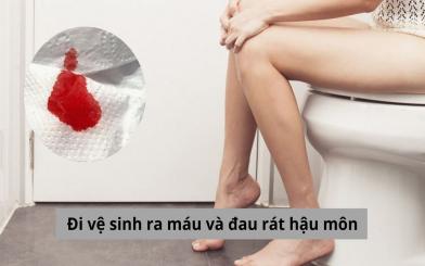 Đi vệ sinh ra máu và đau rát hậu môn là dấu hiệu bệnh gì, nguy hiểm không? 