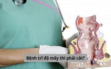 Bệnh trĩ độ mấy thì phải cắt? Cắt trĩ ở đâu Hà Nội tốt nhất?