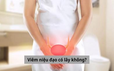Viêm niệu đạo có lây không? Cách phòng ngừa như thế nào?