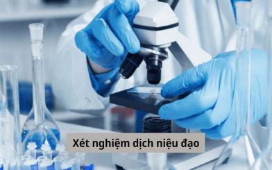 Xét nghiệm dịch niệu đạo và những vấn đề bạn cần biết