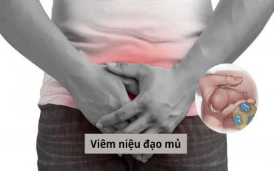 Viêm niệu đạo mủ: Triệu chứng, nguyên nhân và phương pháp điều trị