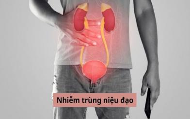 Nhiễm trùng niệu đạo: Nguyên nhân, triệu chứng và điều trị