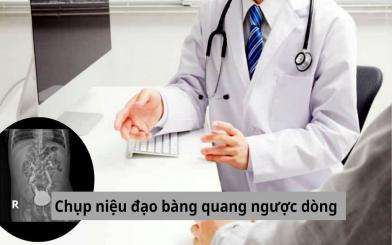 Chụp niệu đạo bàng quang ngược dòng và những thông tin quan trọng bạn cần biết