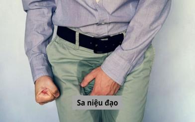 Sa niệu đạo: Đừng chủ quan với những dấu hiệu bất thường